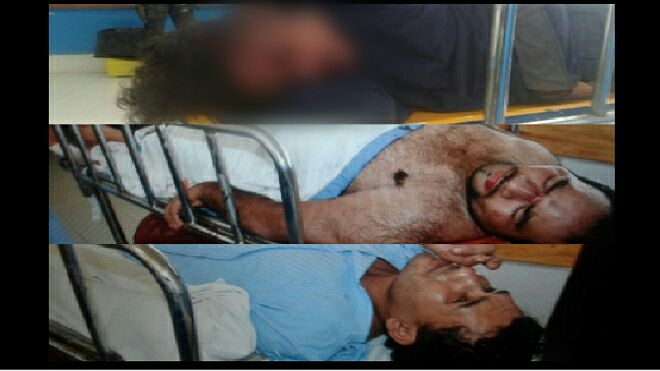 Vapuleados PNC asaltantes jutiapa a balazos ladrones