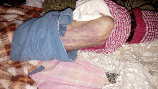 Muere recién nacido en Cobán, se presume que fue golpeado