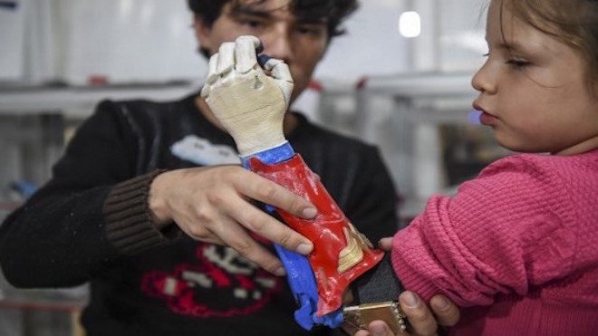 Niños superhéroes, gracias a prótesis impresas en 3D