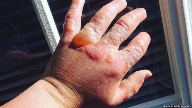 CORTESÍA DE JUSTIN FEHNTRICH Justin y otros meseros cortaron y exprimieron bajo el sol un centenar de limas para preparar cócteles en una fiesta.