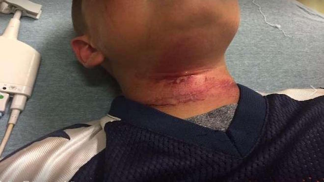Cuelgan a niño de árbol, indagan si fue por tener padres de distintas razas