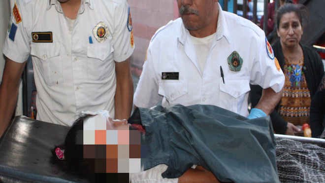 Niña sufre quemaduras en el rostro al explotarle bomba pirotécnica