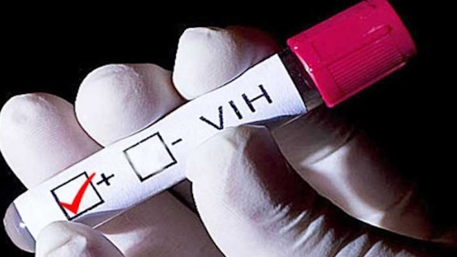 Portadores de VIH a menudo lo saben tres años después del contagio