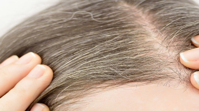 canas