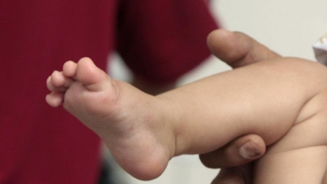 Por qué Islandia se quiere convertir en el primer país de Europa en prohibir la circuncisión masculina