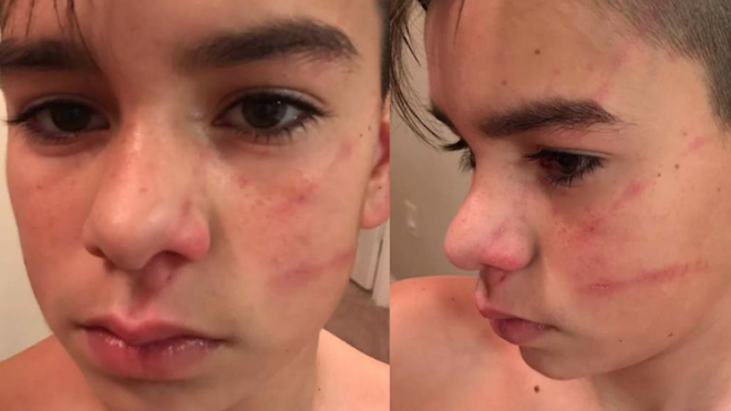 VIDEO: Niños racistas golpean brutalmente a otro en EE.UU. por hablar español