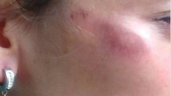 Mujer narra su infierno sexual al salir de la USAC