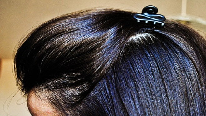 ¿Por qué aumenta la grasa en el cabello?