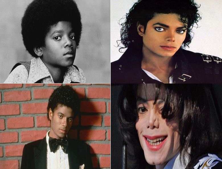 La impactante transformación de Michael Jackson, una vida de cirugías