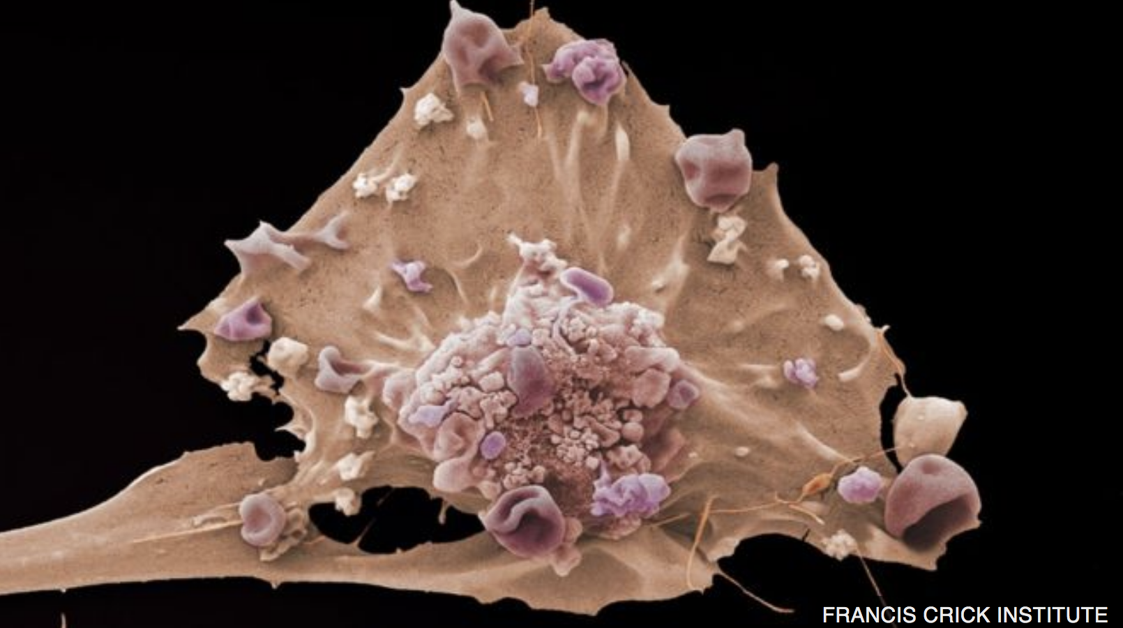 Cómo “nace” el cáncer: los científicos que buscan detectar las señales más precoces de la enfermedad antes de que emerja