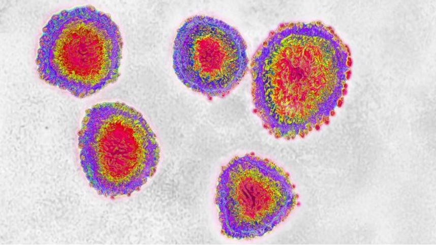 MSPAS en espera de definir acciones para atender alerta por coronavirus en el país