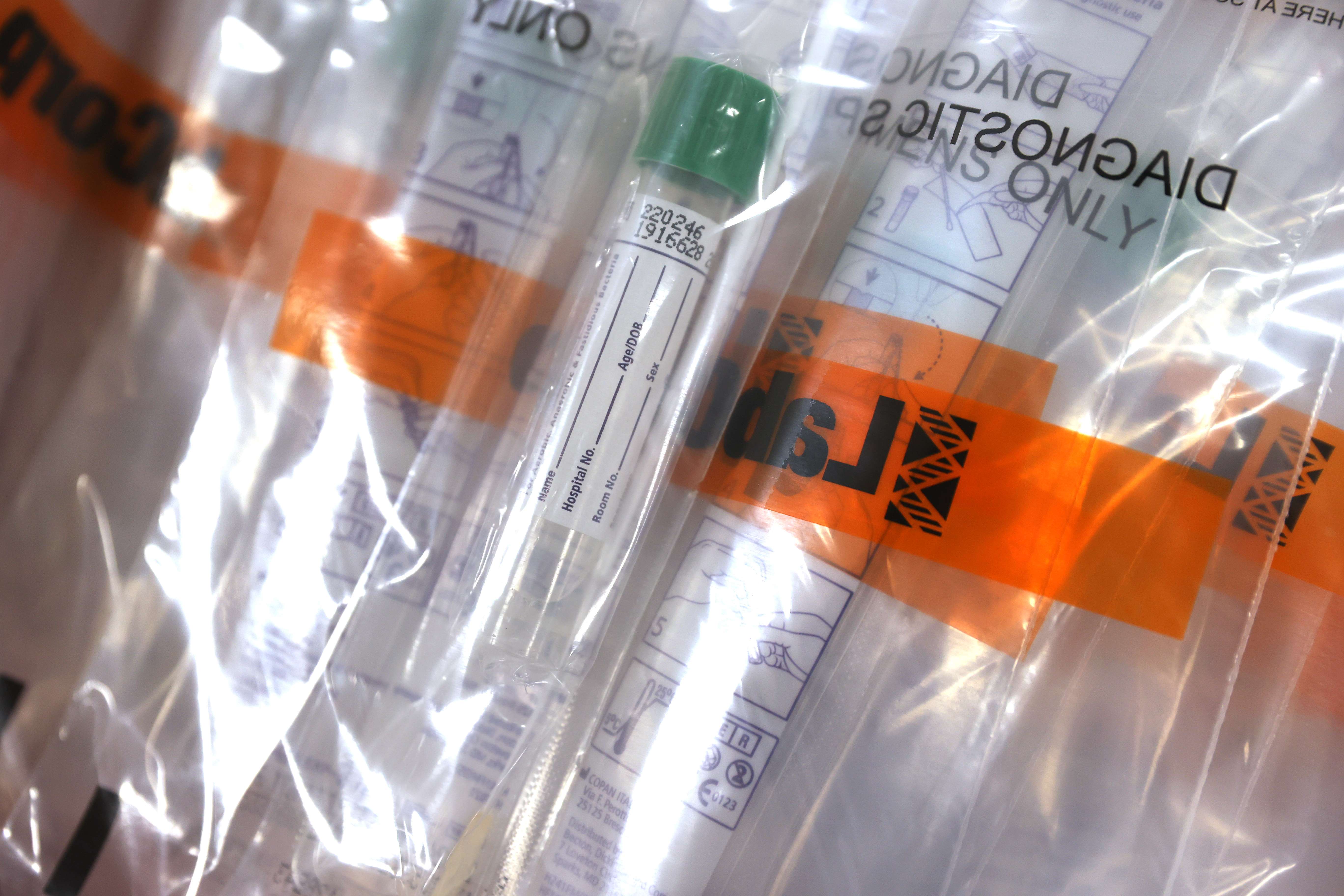 Coronavirus covid-19