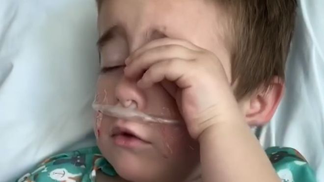 Lincoln tuvo una fiebre alta y no dejaba de toser. (Foto Guatevisión: Archivo personal/Anna Zimmermann)