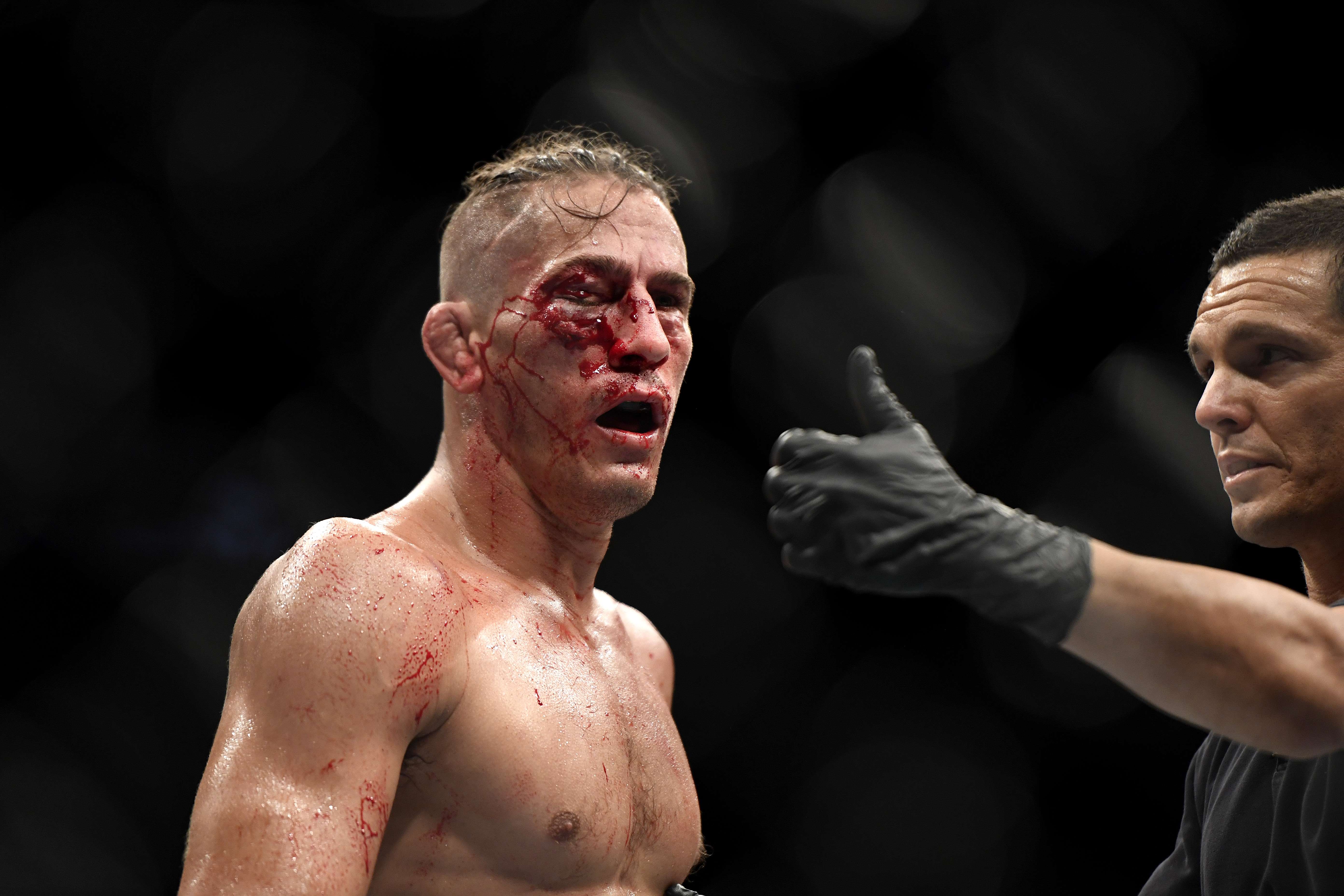 Con el rostro destrozado: esta fue la impactante lesión que sufrió un luchador de la UFC