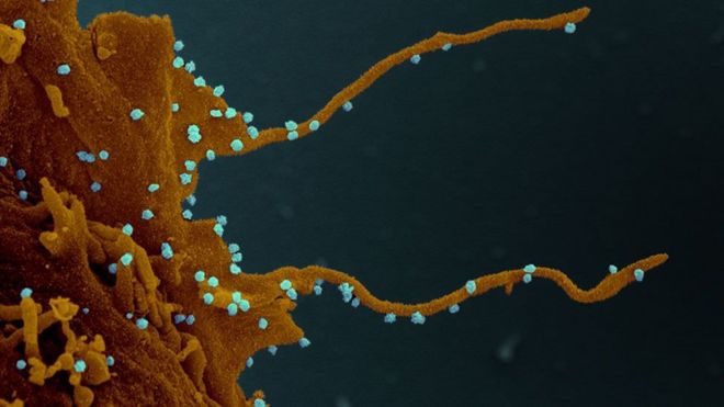 Consecuencias del coronavirus: la “siniestra” transformación que el Sars-Cov-2 provoca en las células humanas infectadas