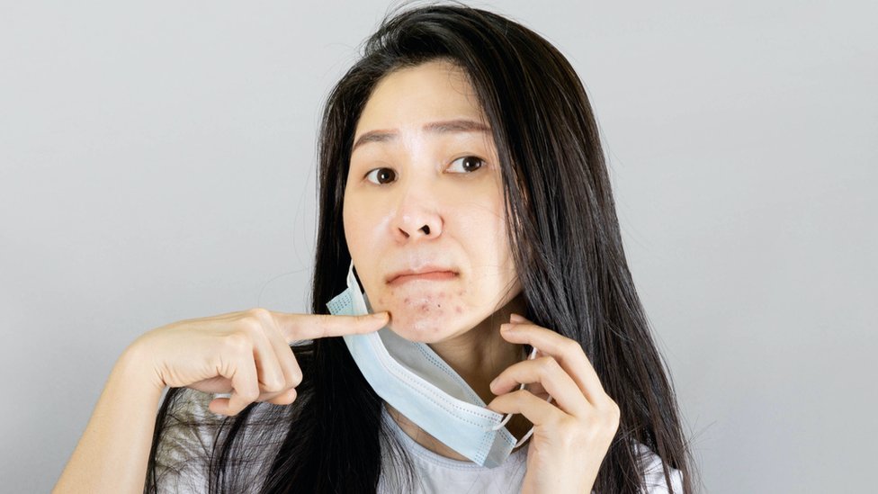 Coronavirus: cómo lidiar con el “maskne”, el acné por el uso de la mascarilla
