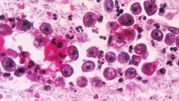 Ameba “come cerebros”: las autoridades de Florida emiten una alerta de salud tras un raro caso de infección por el parásito