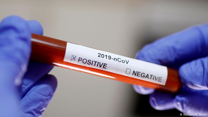 The Lancet: impacto de COVID-19 puede elevar muertes por VIH, tuberculosis y malaria