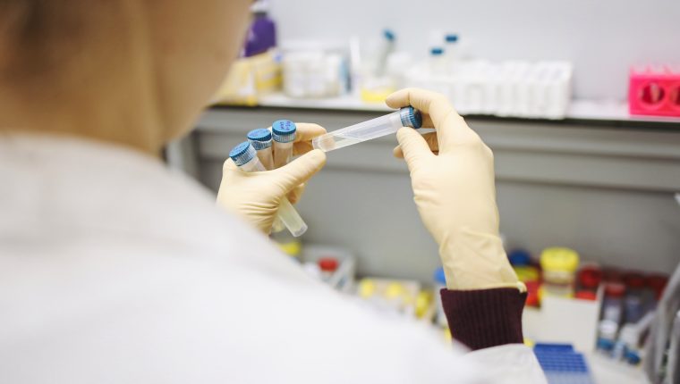 Rusia dice que tiene listo el primer lote de vacunas contra el coronavirus