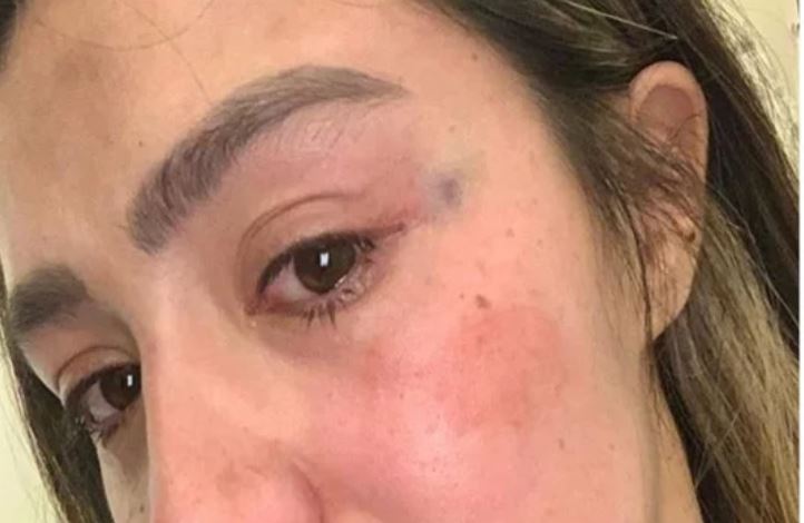 Instagramer denuncia a agresor: “33 días después del parto recibí patadas, recibí golpes en la cara”