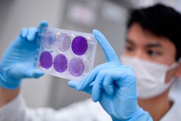 Vacuna contra el coronavirus: Rusia ya tiene fecha para registrar tratamiento