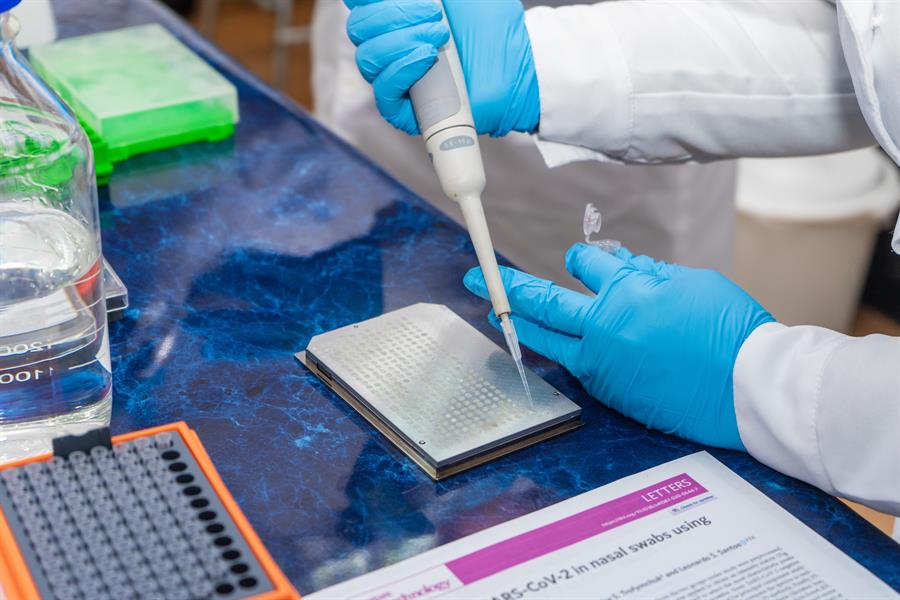 En esto consiste el test contra el coronavirus que crearon en Chile