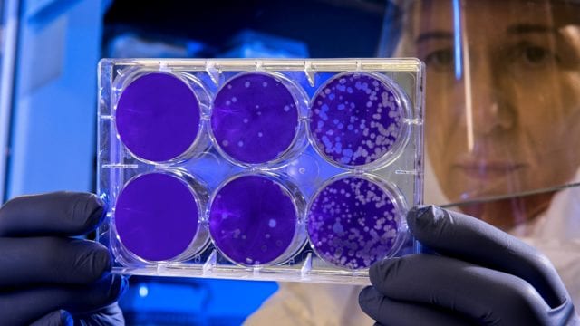 La otra cara de los virus: no solo afectan la salud, también la protegen