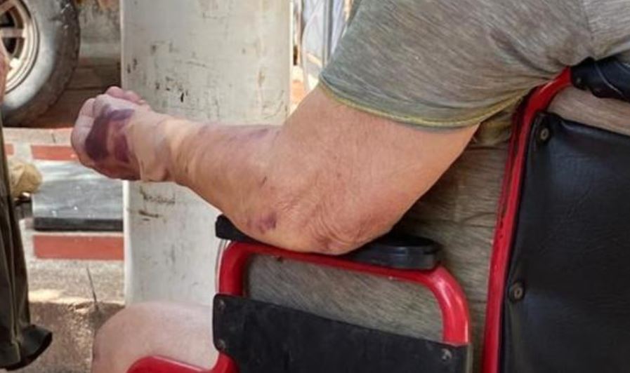 Le cortan la luz a paciente de 93 años y murió porque respirador dejó de funcionar