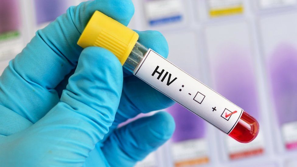 Cabotegravir, el nuevo tratamiento inyectable “altamente eficaz” en la prevención del VIH