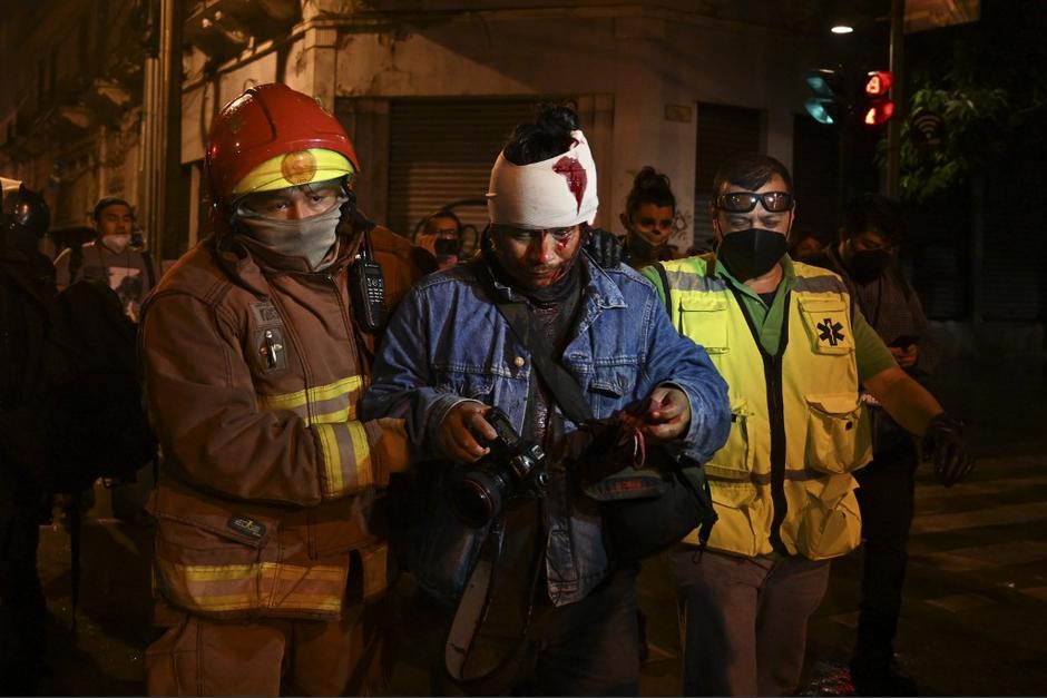 Carlos Sebastián es auxiliado por bomberos luego de ser agredido por un policía antimotines. Foto: AFP