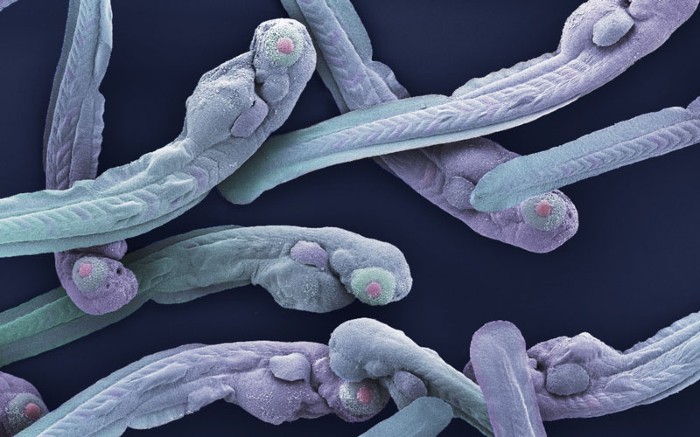 Qué se sabe del brote de norovirus en China que afecta a los niños (y que ha estado presente en Guatemala)