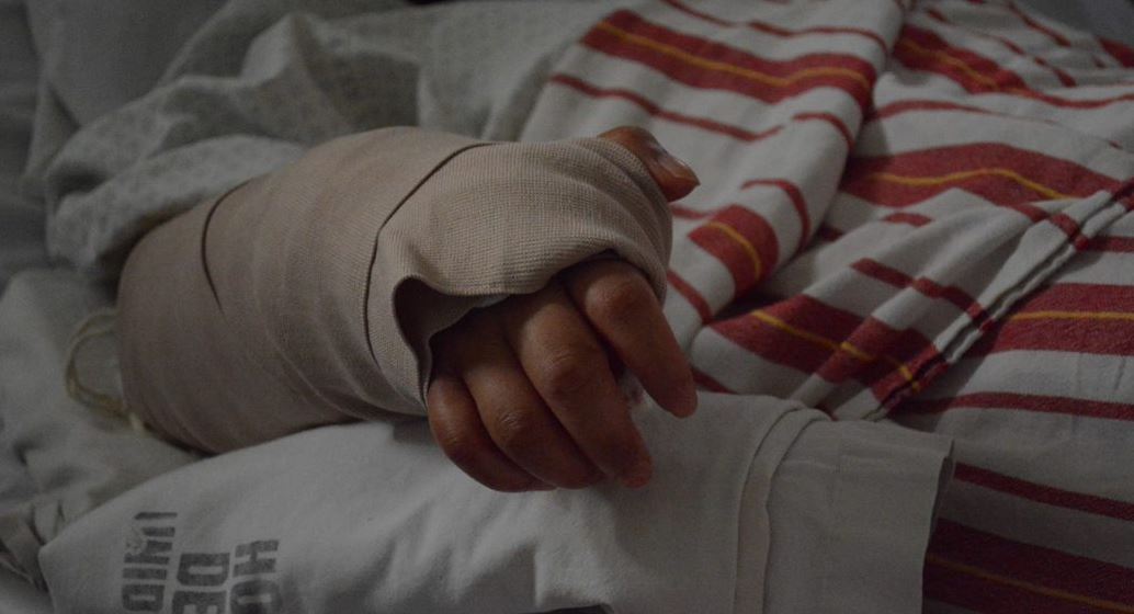 La historia de la joven a la que médicos le reconstruyeron la mano en el Hospital de Amatitlán