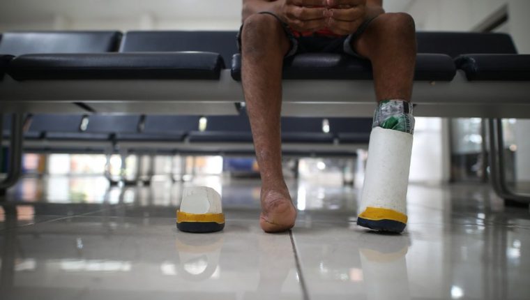 La lucha por salir adelante del colombiano que perdió los pies por el ataque de un cerdo cuando era bebé