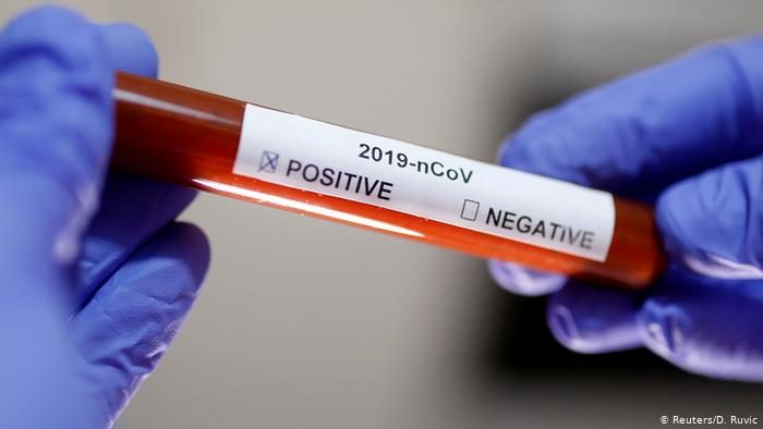 Profesor de Harvard: Se puede acabar con el covid-19 en tres semanas