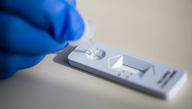 La variante británica del coronavirus es un 45% más contagiosa que el virus original