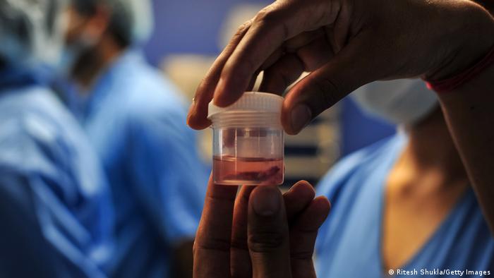 [Viva La Noticia] Síntomas y tratamiento del hongo negro