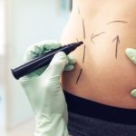 México: cómo la narcoestética está cambiando el cuerpo de las mujeres de Sinaloa