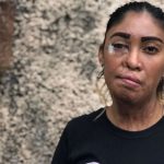 “Me decía que si yo no era suya no iba a ser de nadie. Lo dejé y me atacó con ácido”