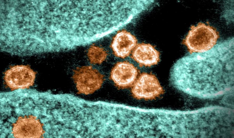 Coronavirus: cómo es la variante “mu” que ya fue identificada en países como Guatemala