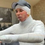La brutal imagen que revela el trágico accidente que el diseñador de Balmain ocultó durante un año