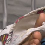 Hospital Roosevelt advierte de que se incrementan las quemaduras en niños y estos son los motivos