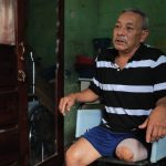 Oscar Osoy vive únicamente con Q25 a la semana para poder comer y necesita una prótesis de pierna
