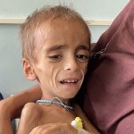 “Una joven rogaba que la mataran a ella y a su bebé”: el hospital en Afganistán donde los niños mueren de desnutrición