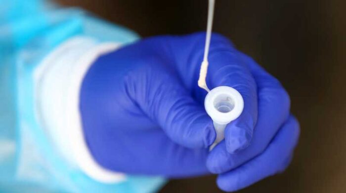 Detectan primer caso de Flurona en México