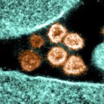 Flurona: detectan en Los Ángeles el primer caso de la extraña infección simultanea entre influenza y covid-19