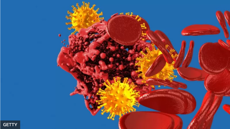 Coronavirus y coágulos: el estudio que halló que padecer covid está asociado a un mayor riesgo de desarrollar trombosis y embolia