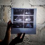 La epidemia normalizada: Embarazos en niñas y jóvenes en Guatemala es una situación escalofriante, afirman expertos