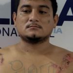 Pandillero salvadoreño se quema los tatuajes en un “desesperado intento” de evitar ser capturado