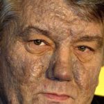 Conozca la historia de Viktor Yushchenko, el presidente ucraniano que fue envenenado y desfigurado por acercarse a la OTAN