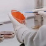 Ministerio de Salud emite circular sobre la viruela del mono, sus síntomas y la forma de prevenir el contagio